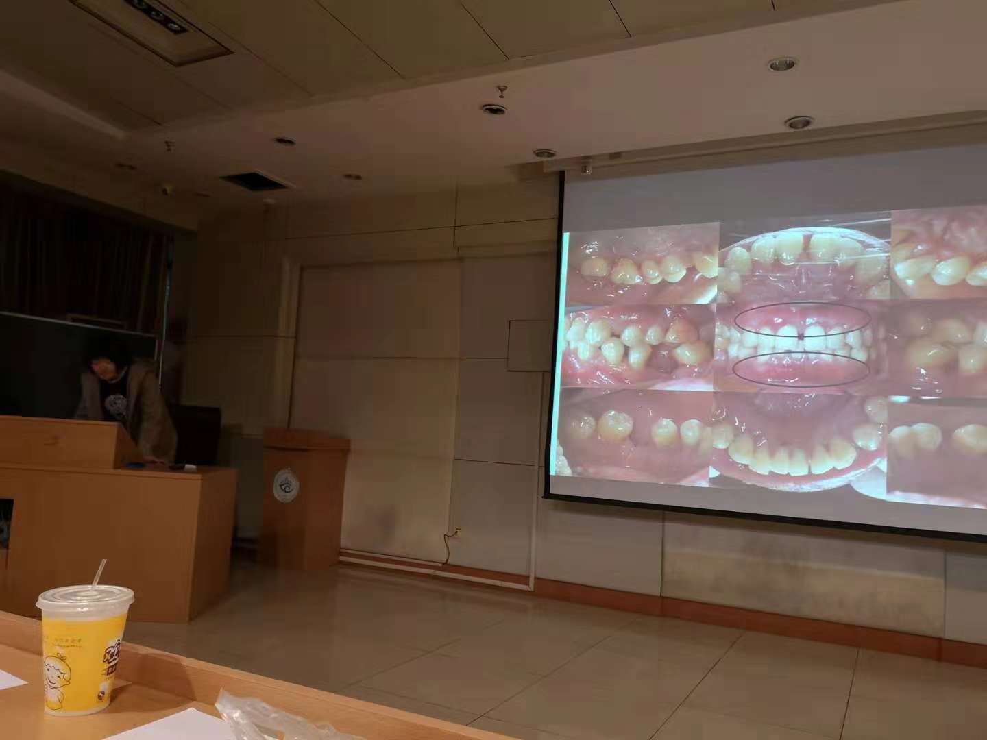 落实规培要求，考核临床实践——2018牙周科规培生出科病例汇报